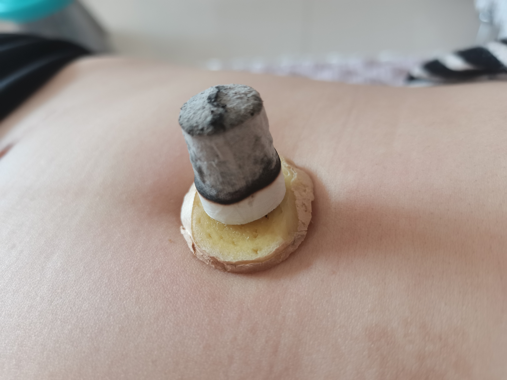 肚子实在太难受,就想到了,倪海厦说的隔姜灸.