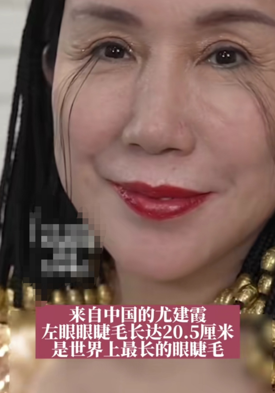 吉尼斯纪录,世界上最长的眼睫毛拥有者,两眼中左眼最长睫毛达20.