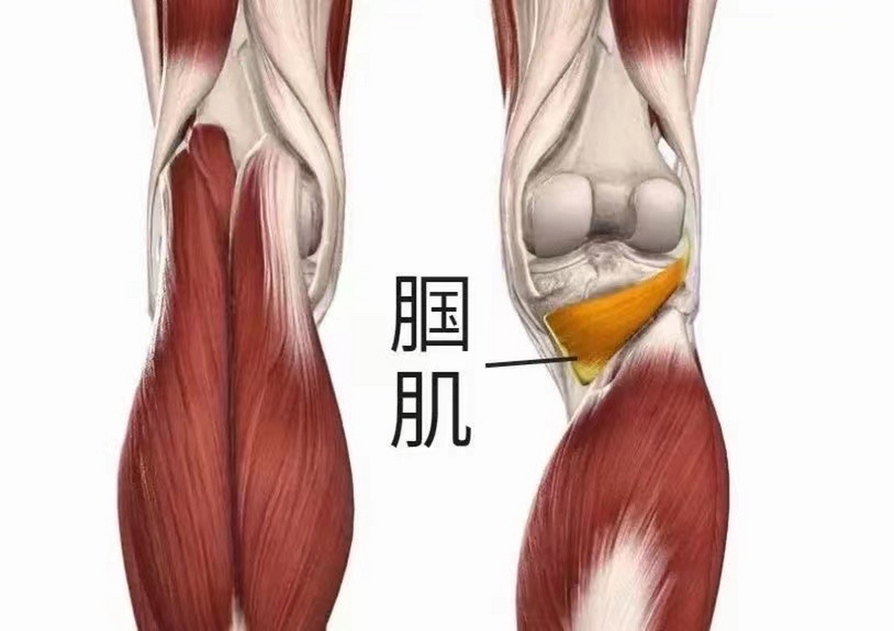腘肌损伤主要表现为 ☆02膝盖后方空间(腘窝)轻度肿胀 ☆02走路
