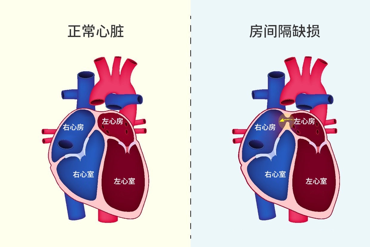 房间隔 baijiahao.baidu.com