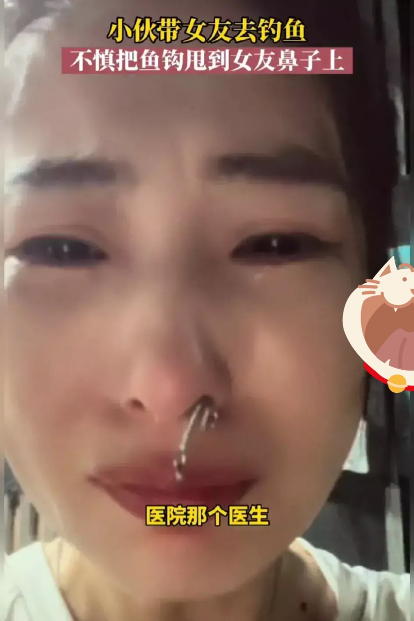 近日,一则关于潍坊男子将鱼钩甩到女友鼻子上成鼻环的新闻引起了广泛