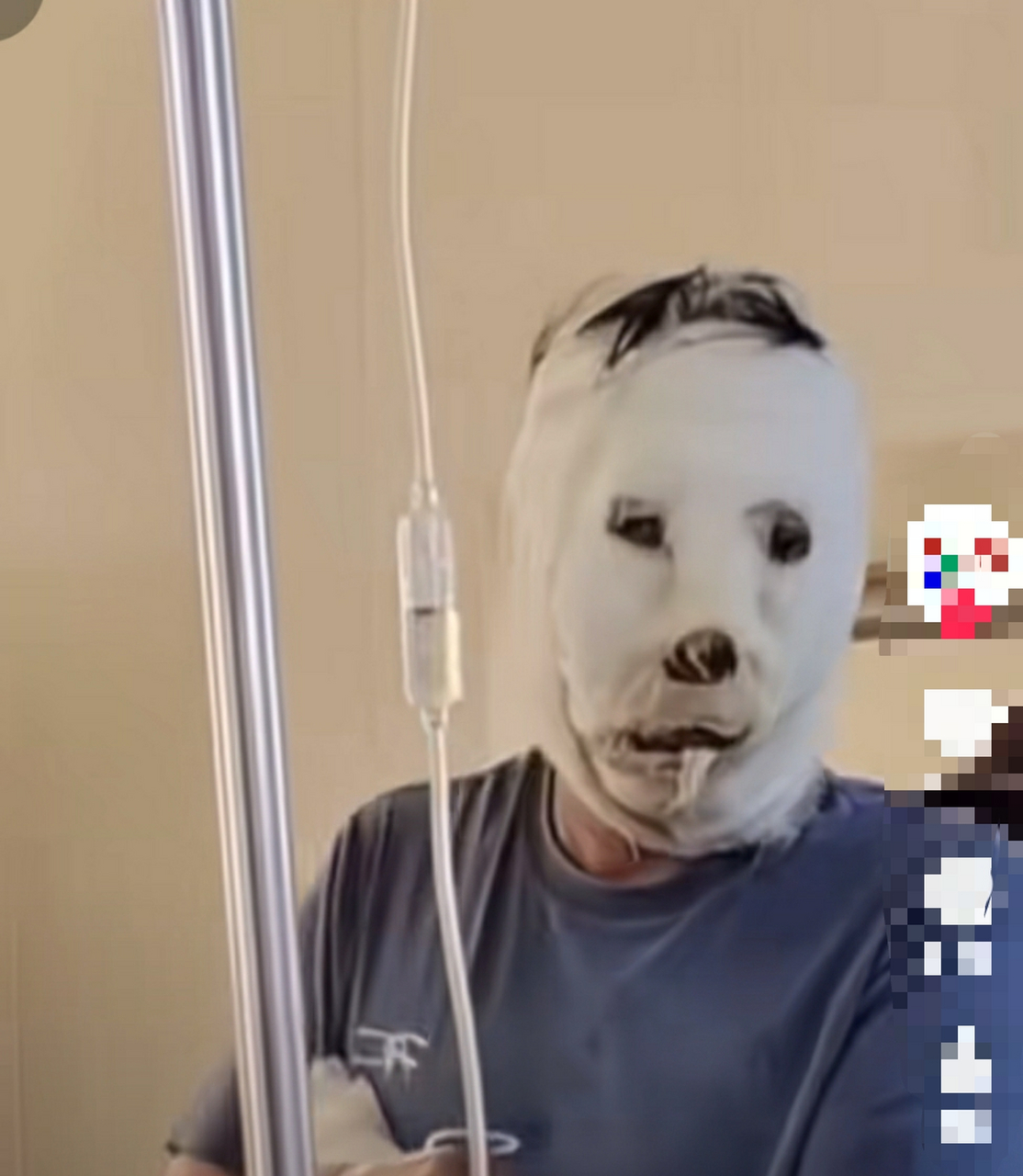 这个包扎手法不多见,网友:把我功德笑没了 我就想知道给他包脸的的人