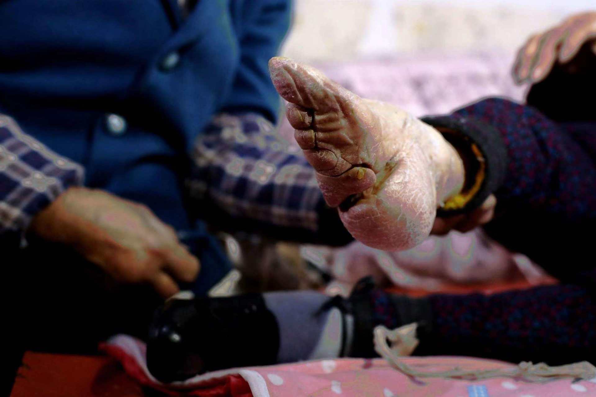 裹脚对古代女性的影响有多大?