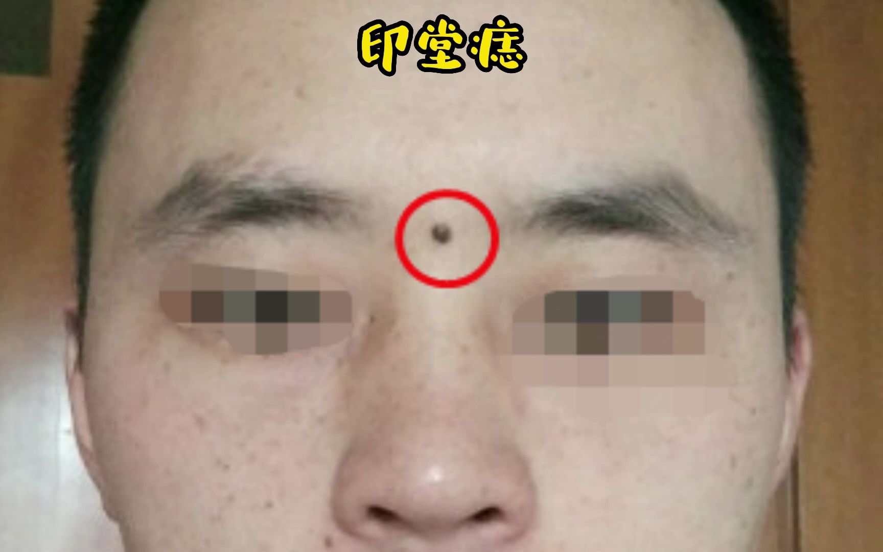 如果这些地方长朱砂痣地方要小心了