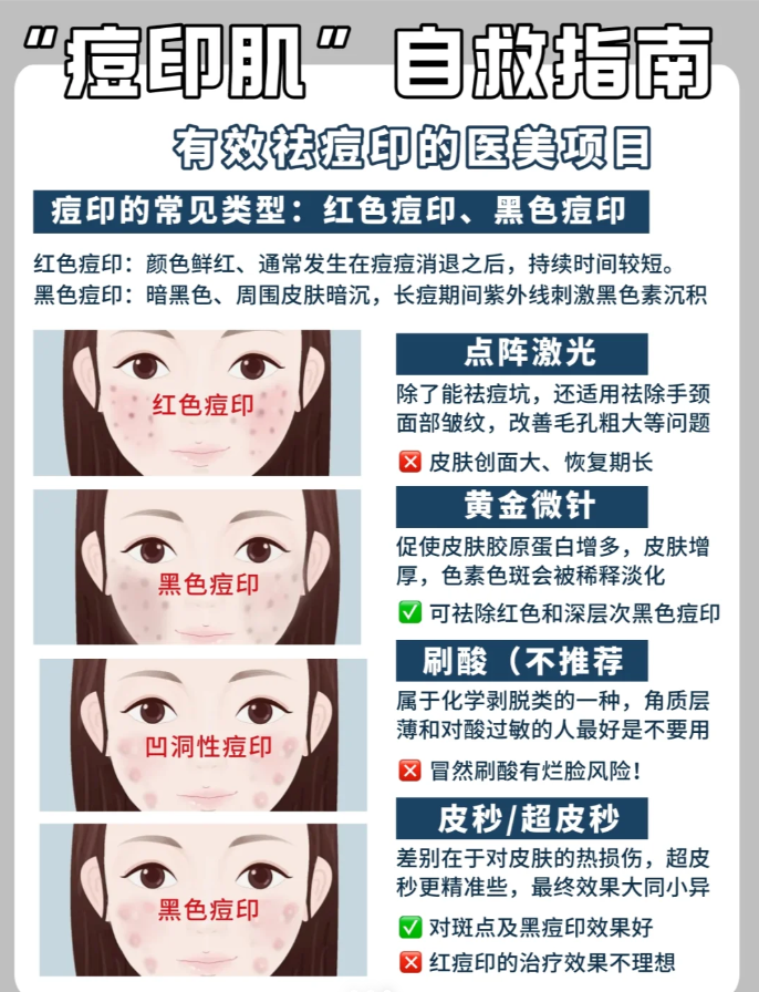 痘痘,痘坑,痘印一篇说清楚!有效祛痘干货