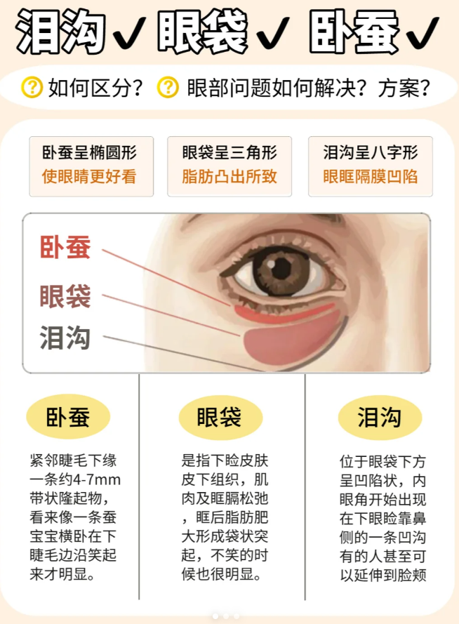 一图快速区分泪沟