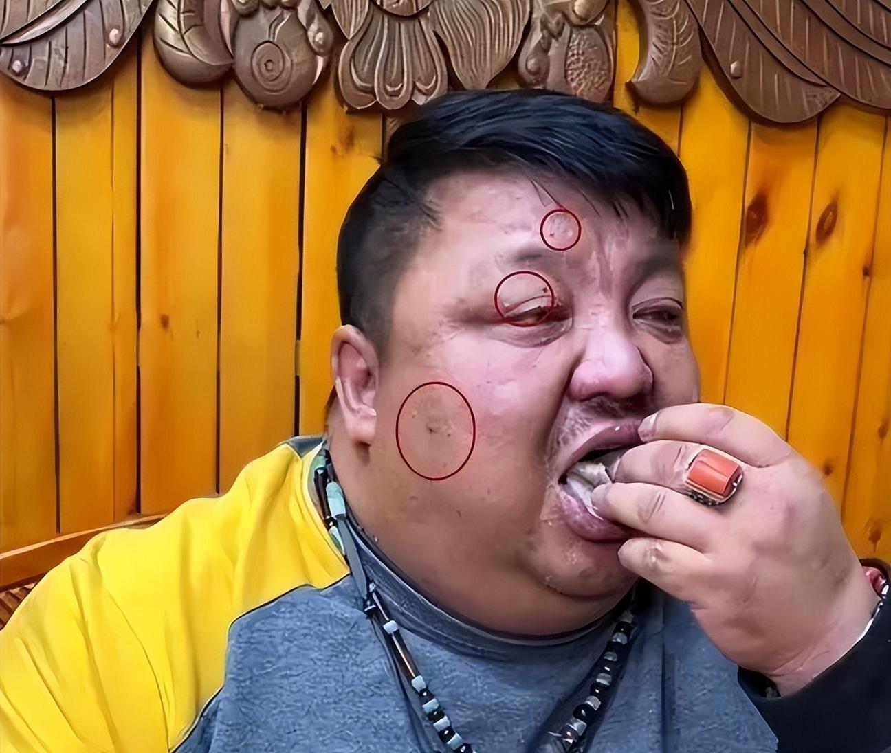 羊亡爷”恩克：半年吃掉110只羊面色发黑神情呆滞，曾直播吐血