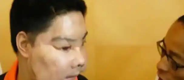 中国换脸第一人李国兴,不听医生劝告执意出院,半年后离奇死亡