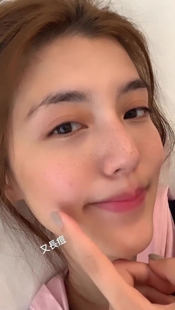 组图:又长痘!吴千语自揭"疮疤" 近镜自拍晒素颜现雀斑