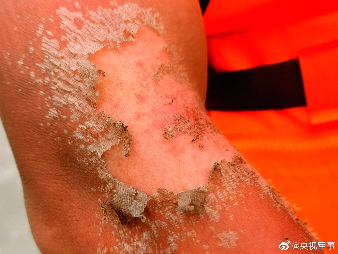 心疼!抗洪空降兵说脱皮血泡都是勋章