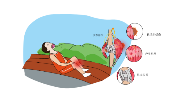 肌肉拉伤卡通图片图片