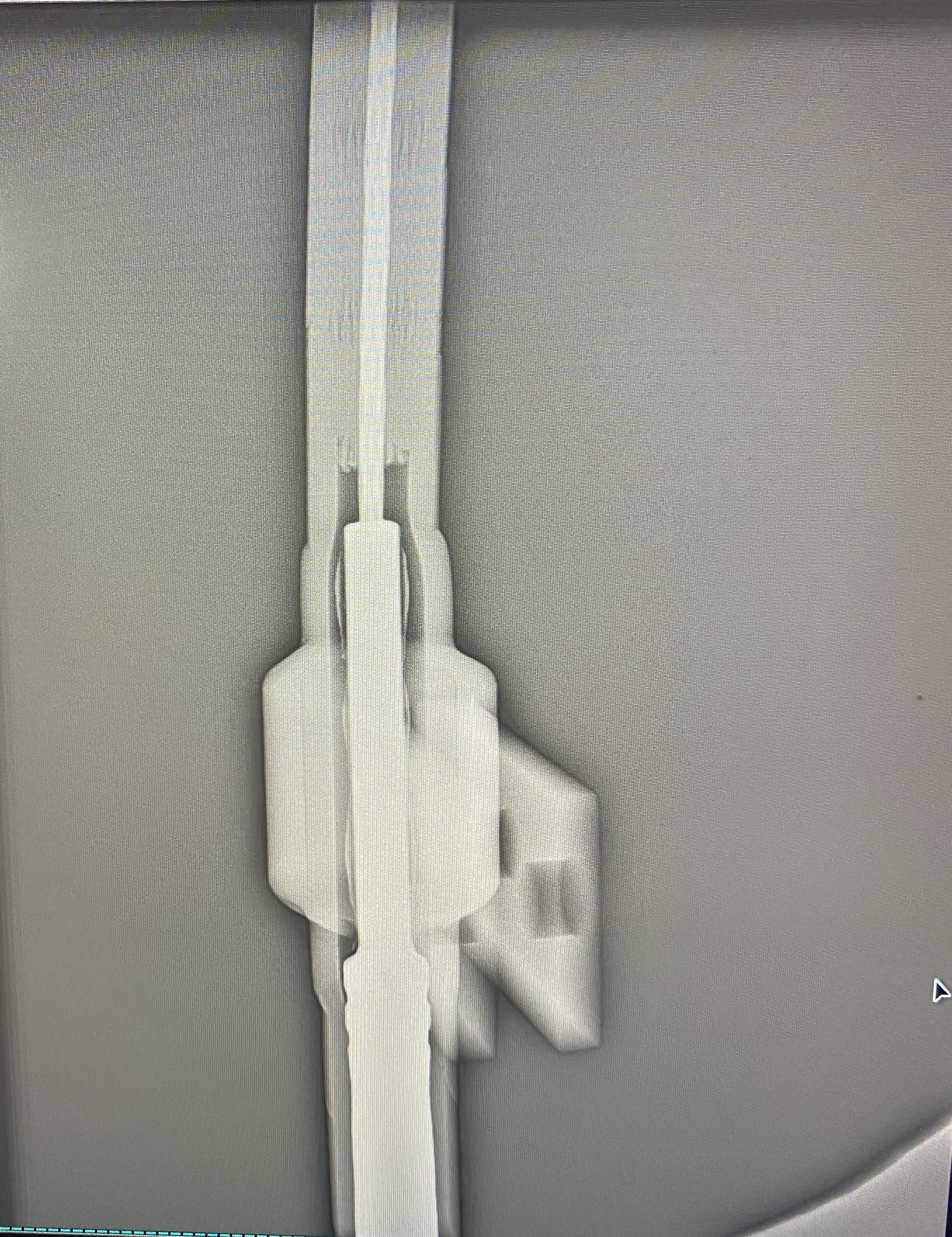 便携式x射线检查仪,便携式x光机在耐张线夹,电力无损检测的应用