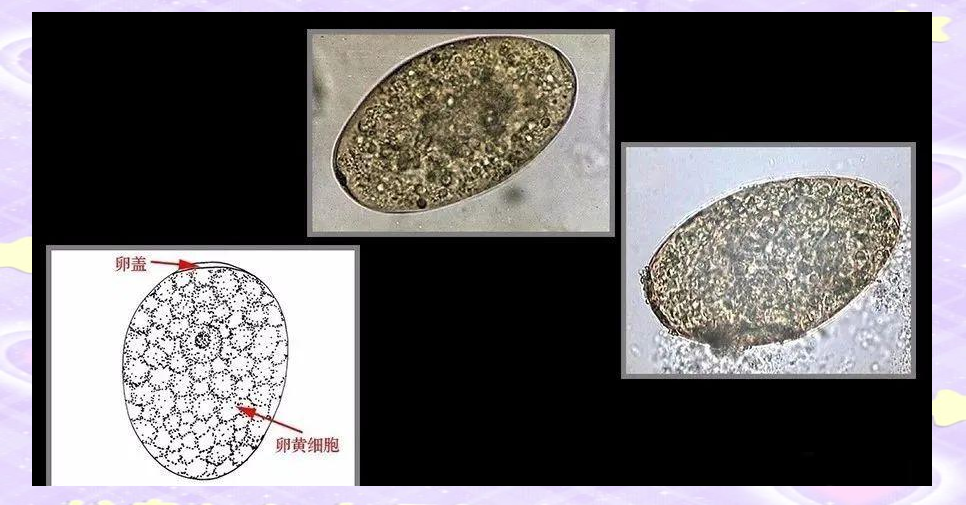 揭秘常见寄生虫卵的形态与大小