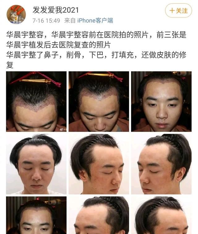 华晨宇演唱会整容对比图片