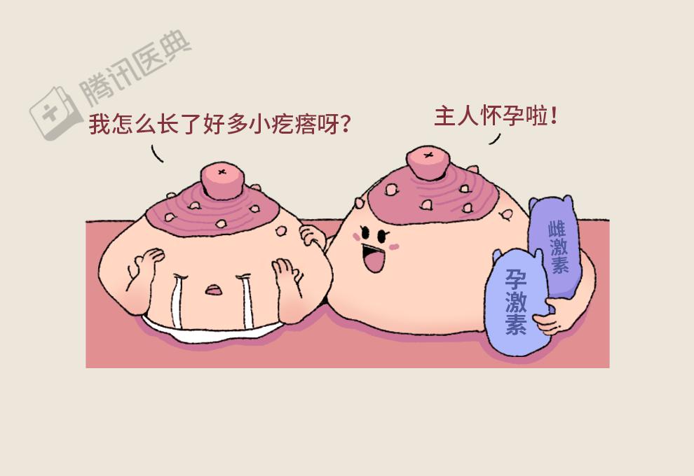 乳房头上有小疙瘩图片图片