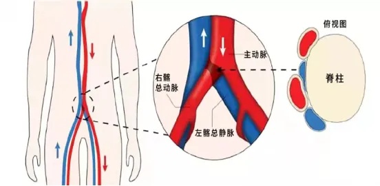 大腿主动脉图片