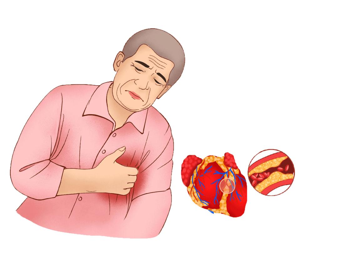 【浦公英】警惕这个心脑血管疾病的"魔鬼时刻"!