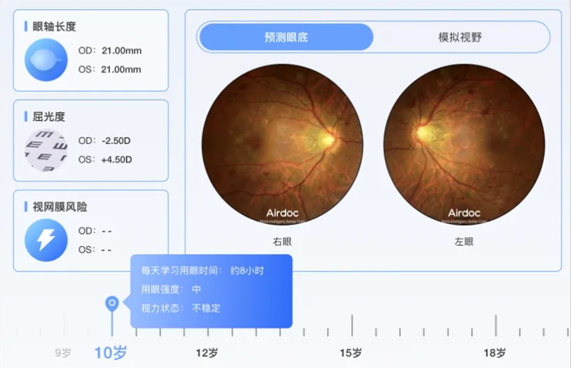 眼底照相是检查什么图片