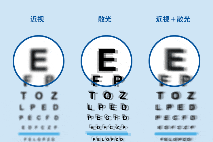 近视和散光的预防措施一样吗?90%的家长都不知道
