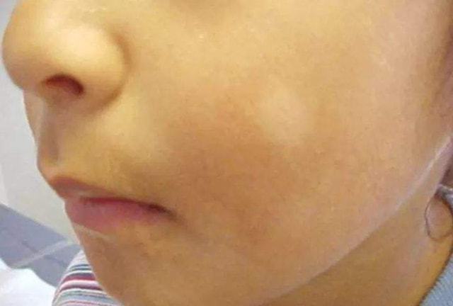 肝病专家提醒:小便长期发黄,很可能不是上火!