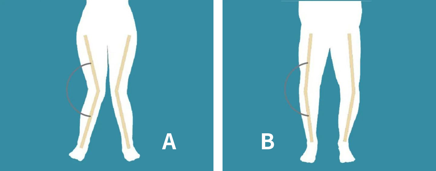 是膝盖最害怕的姿势?