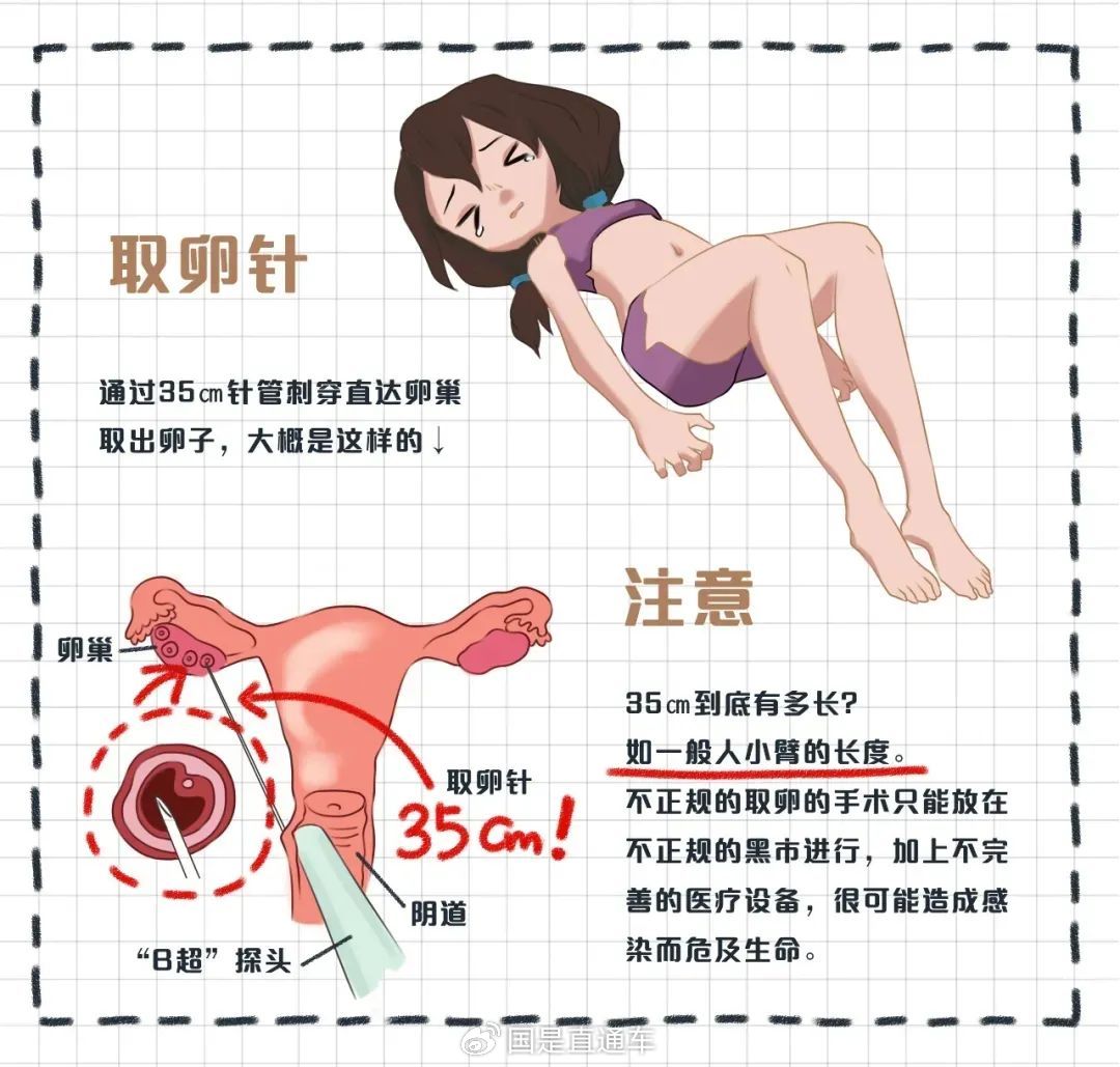 2025年最新正规有偿捐卵推荐(今日分享正规有偿捐卵公司机构)
