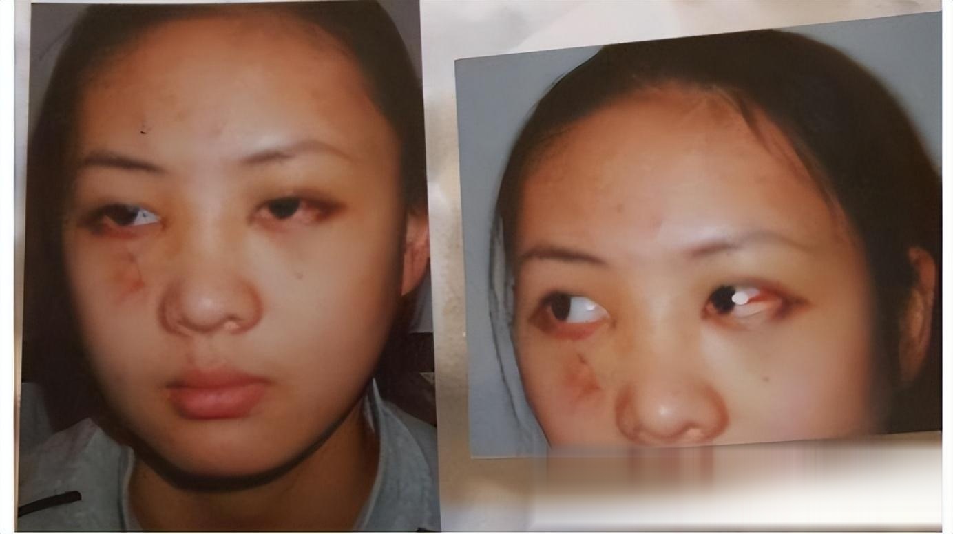 童瑶:被张默当街殴打,嫁大17岁富商王冉,已是张默高攀不起的人