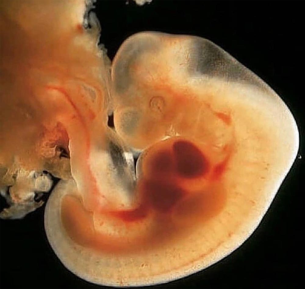 五十天流产胎儿图片图片