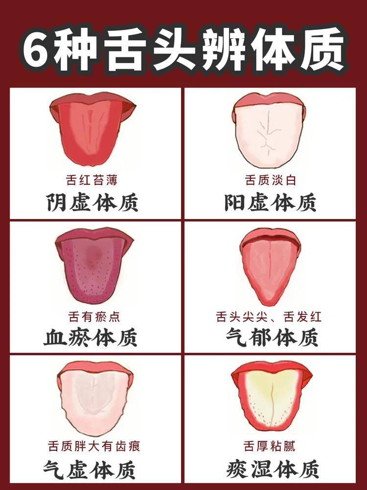 中医讲究看舌象:6种体质看舌头或能分辨,快测测你是哪种体质?