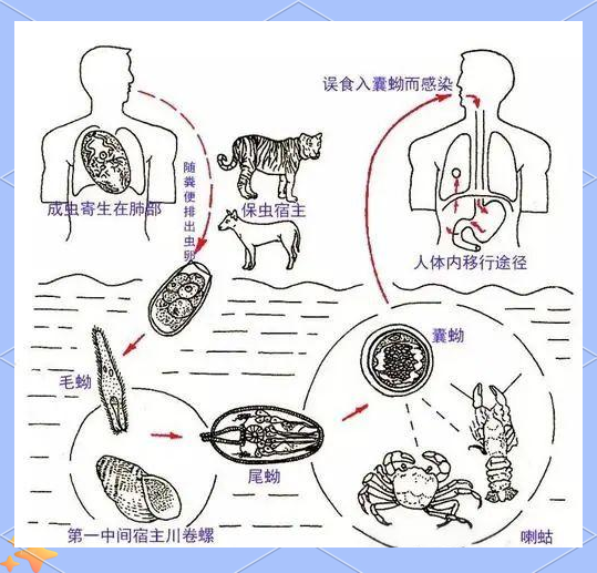 肺吸虫病:感染原因及防治全攻略