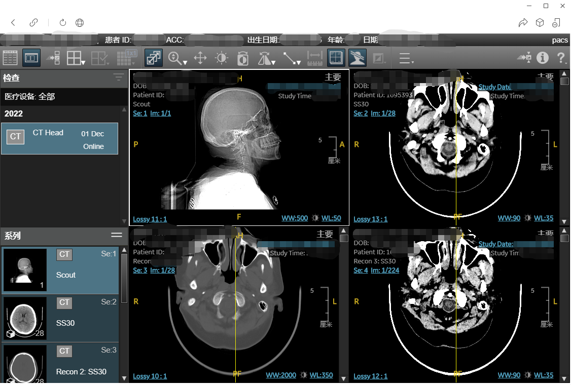 清远人医"云胶片"上线,片子,报告扫码可见