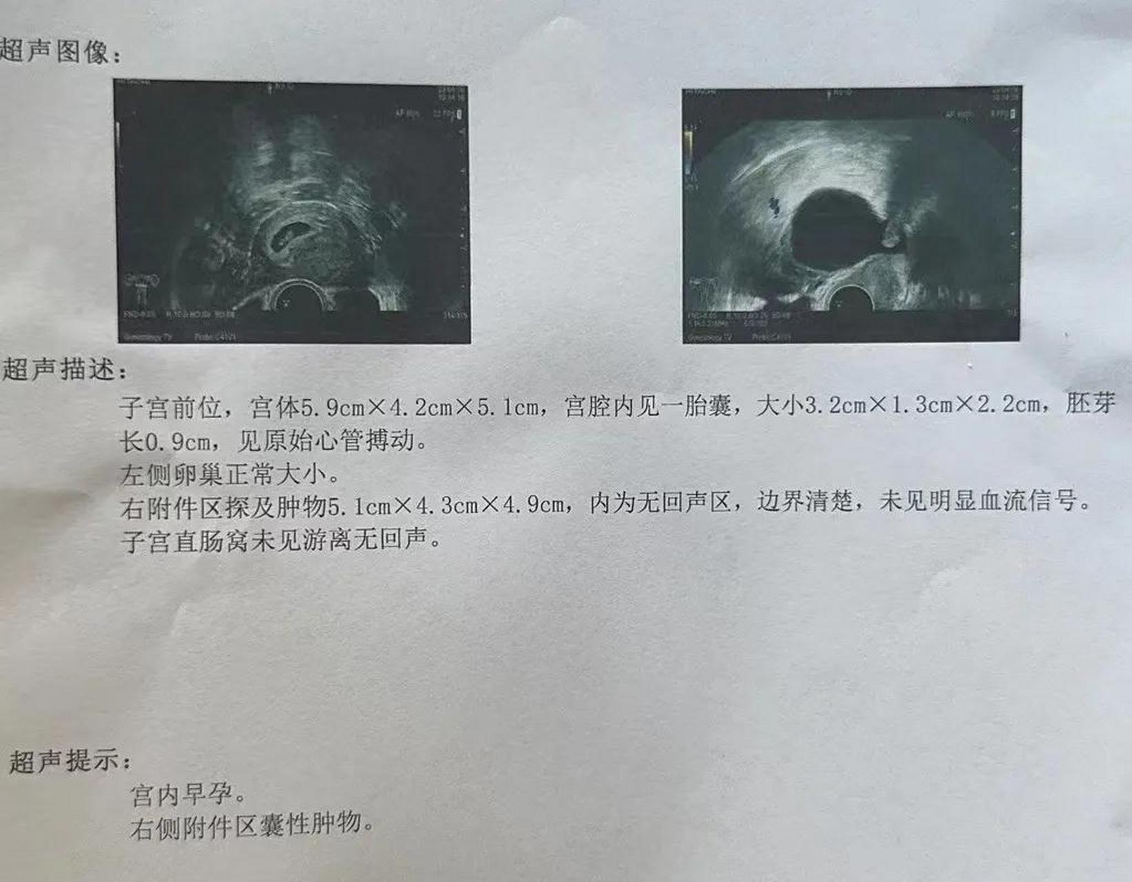 门诊看到一张彩超单,我说怀孕7周多.她一直追问,具体哪天怀上的?