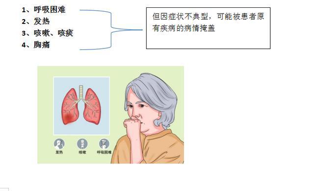 卧床患者如何预防坠积性肺炎?
