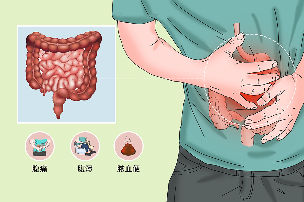 大便带脓血就是溃疡性结肠炎吗?