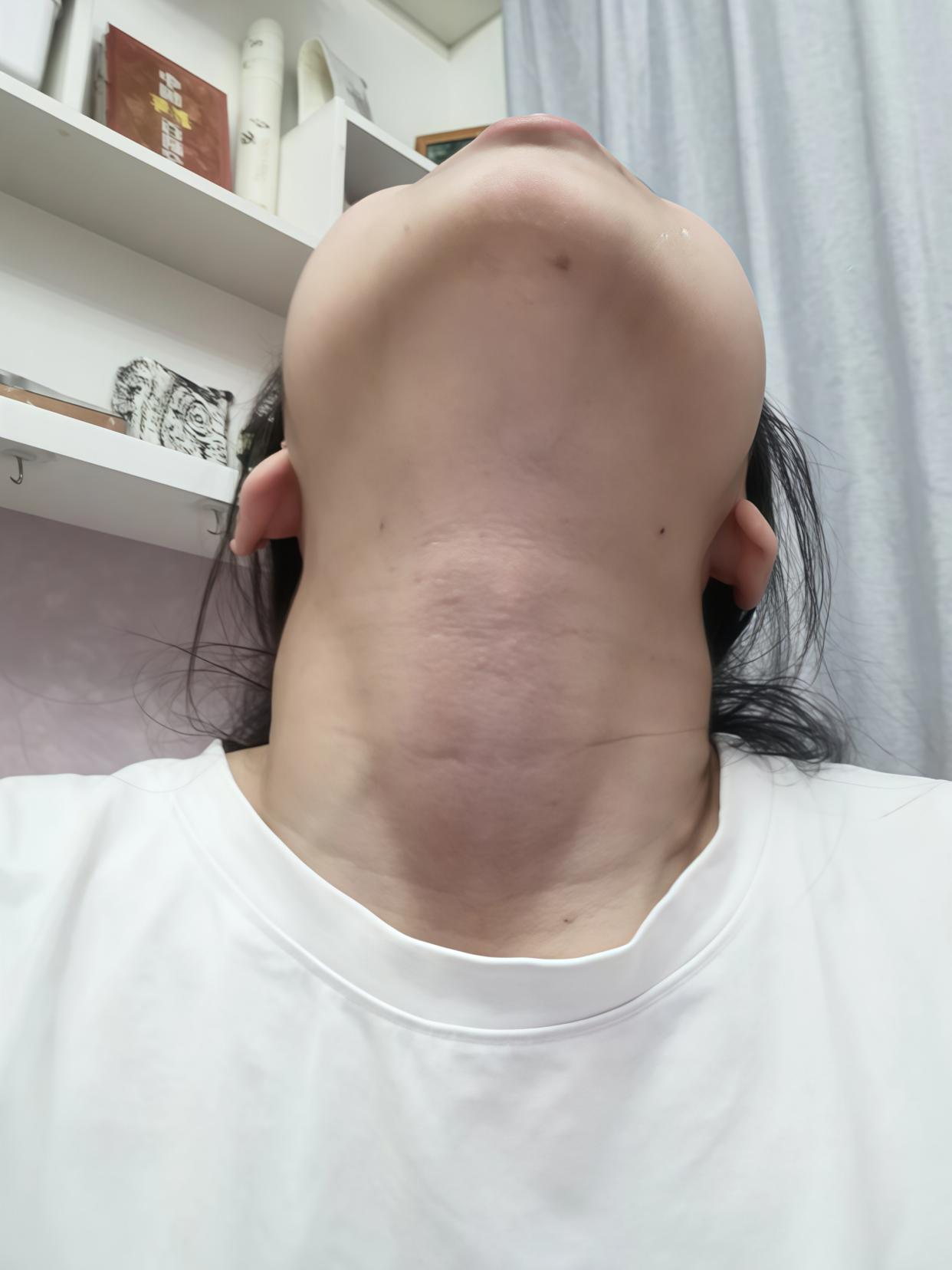 海带补钾是万能菜?这三类人越吃越伤身