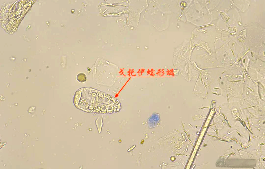 常见病原体全解析：深入探讨寄生虫、细菌与真菌的特性