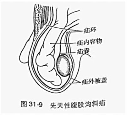男性腹股沟位置图片图片