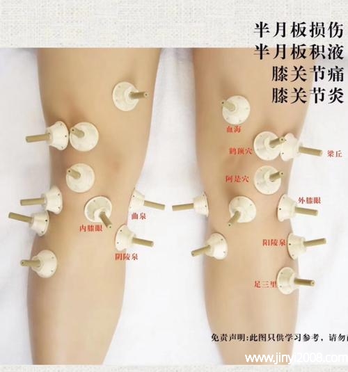 艾灸膝盖积液多久见效