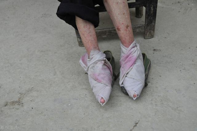 国学大师辜鸿铭喜闻妻子小脚 把玩不够还闻脚味道?