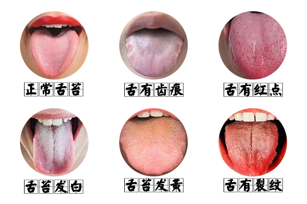 齿痕舌会自愈吗 baijiahao.baidu.com