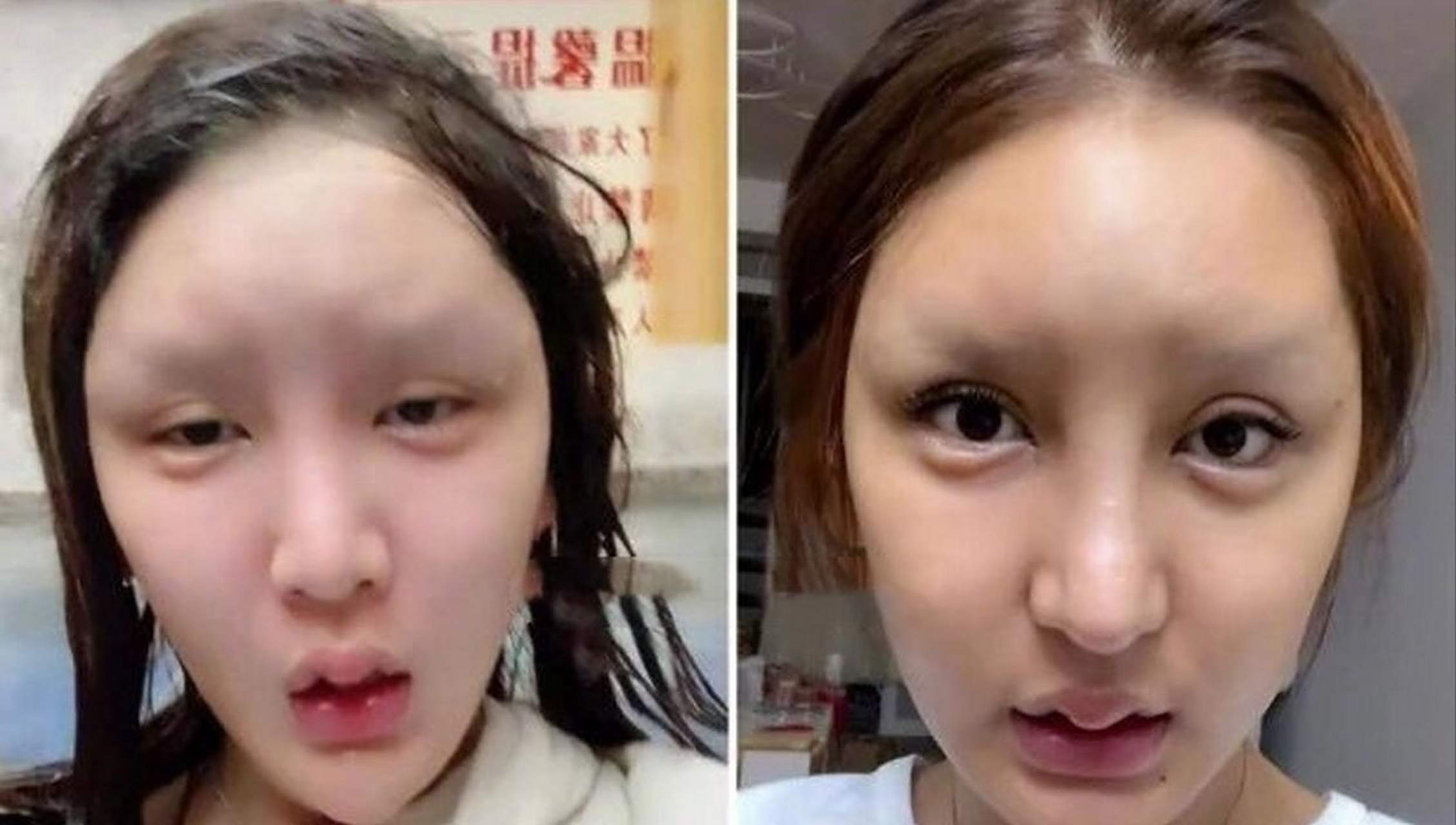 人造美女"桃花宝宝",8年整容连亲妈都快认不出,这是图啥呢?