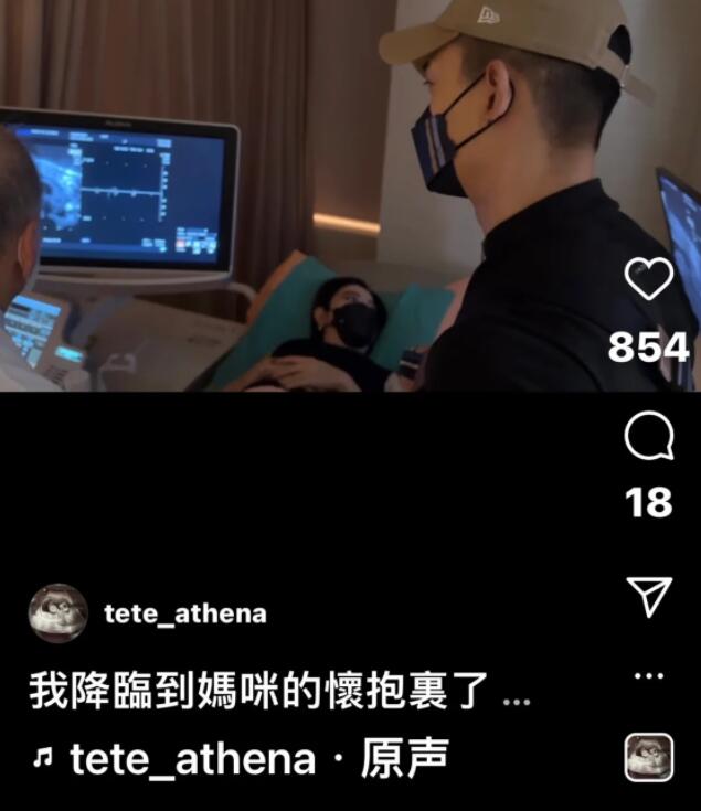 41岁许维恩宣布怀孕,晒b超公布女儿名字,经纪人回应:不是试管