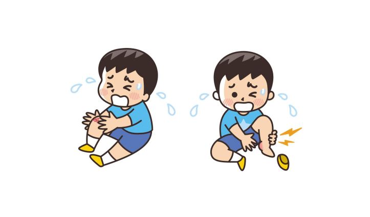 宝宝磕碰难避免,如何处理孩子伤口一篇文章讲明!