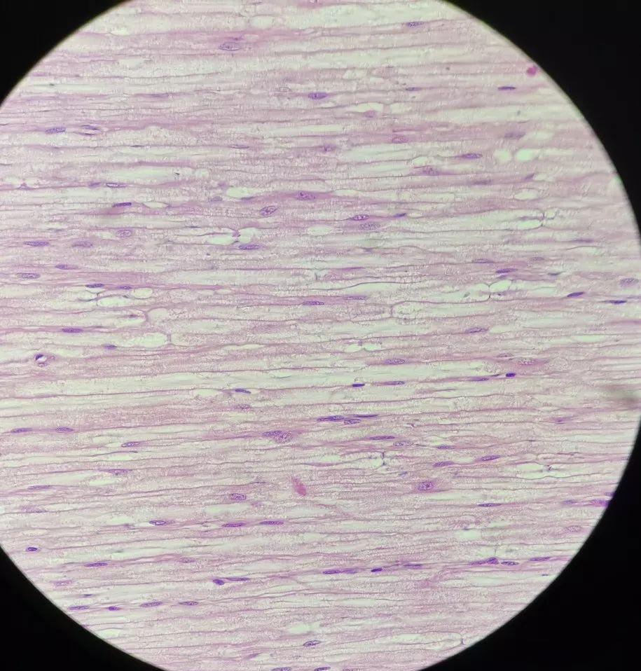 有髓神经纤维的解剖结构如下:在纵切面上,我们可以清晰地看到郎飞结和