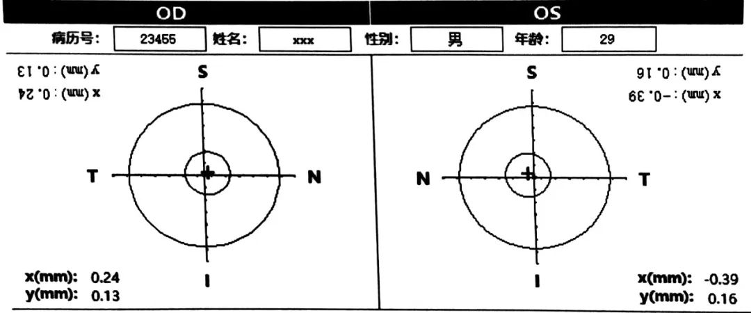 kappa角测量方法图片