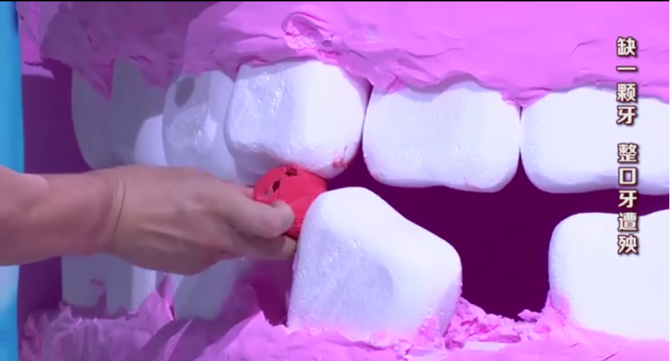 北京中诺第二口腔医院种植专家梁磊解密:如何让种植牙更长久呢?