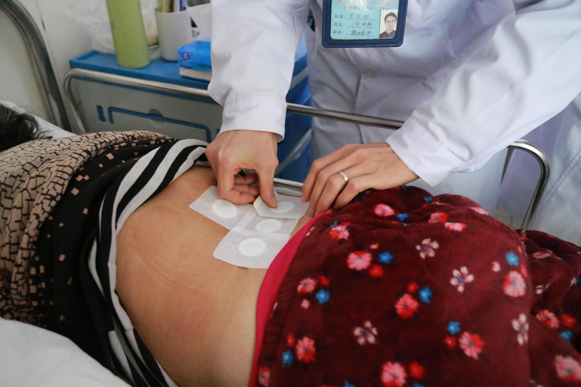 治病求本!值得推介的"穴位贴敷疗法"