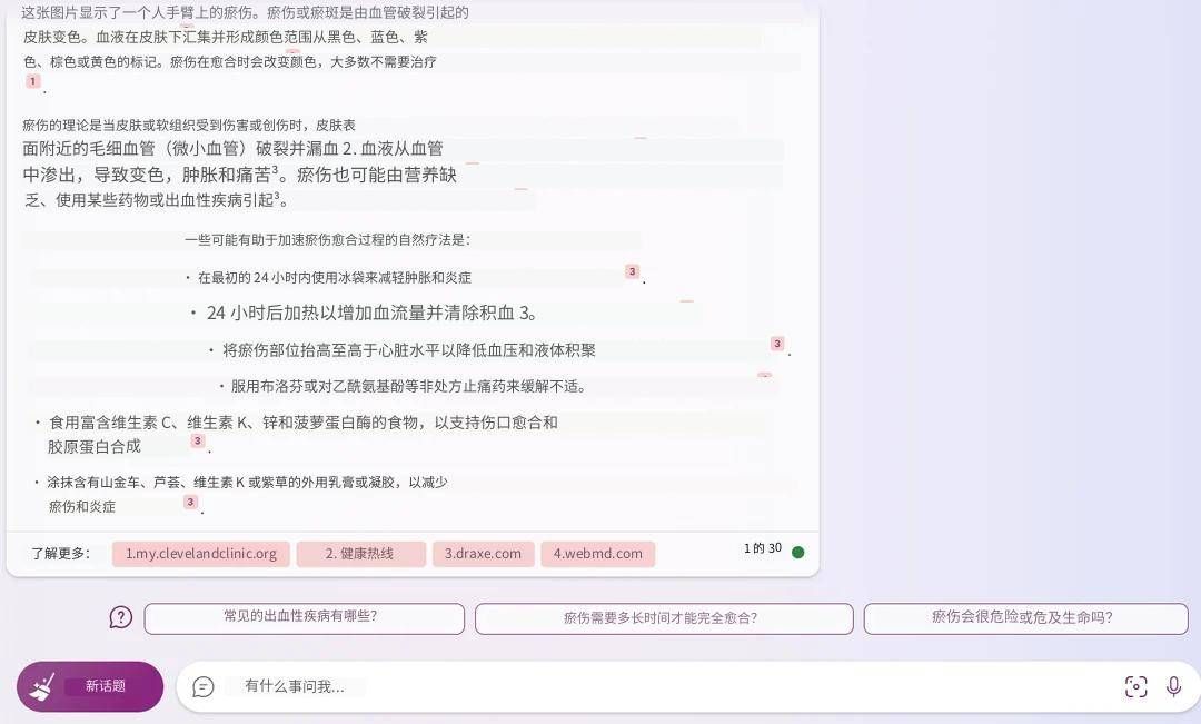 bing搶先chatgpt支持識圖功能,能看懂梗圖,還能「看病」