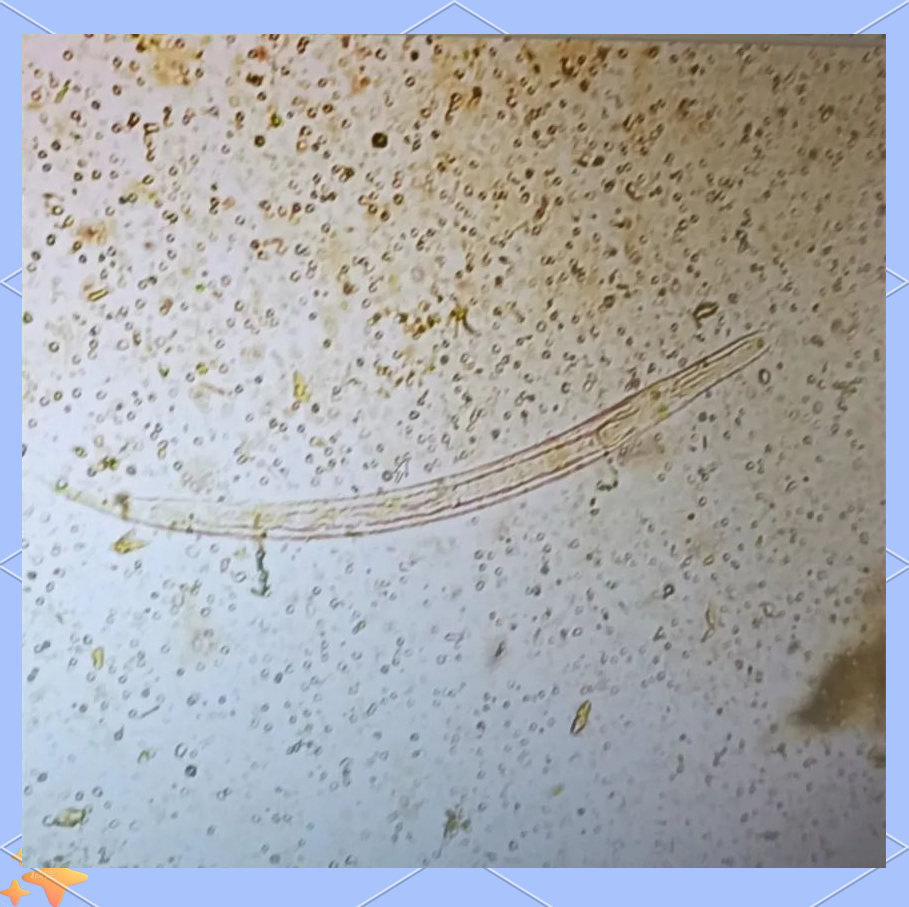 探秘显微世界:识别并了解粪类圆线虫