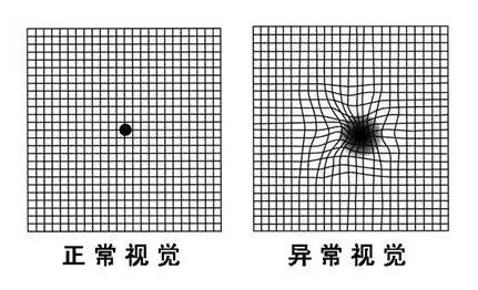 眼睛看物体变形图片